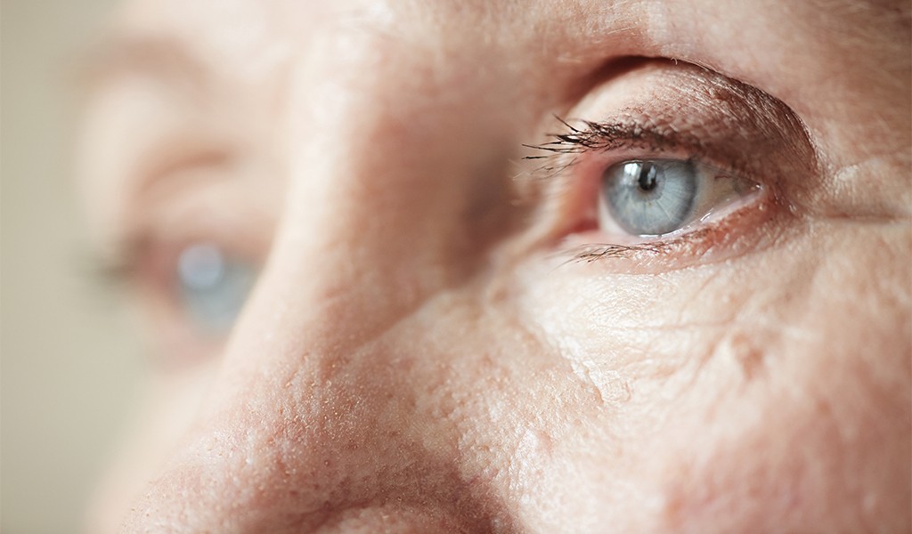 Gözlerin Sinsi Düşmanı Glokom Kör Edebilir: Dünyagöz Hastanesi