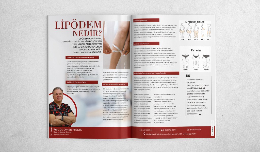 ORHAN FINDIK - Lipödem Nedir?